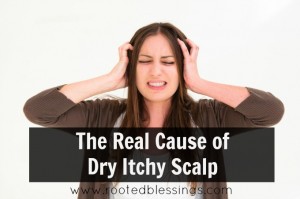 dry itchy scalp